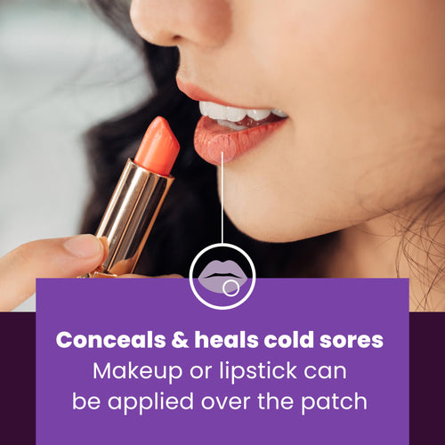 15 Hydrocolloid Cold Sore Patches K50673