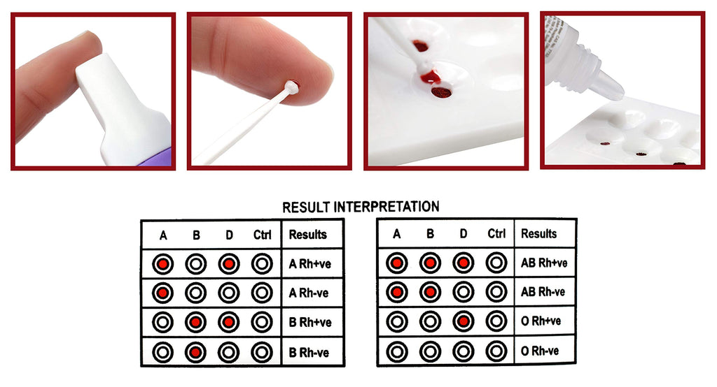 Blood Type Test Kit I941140